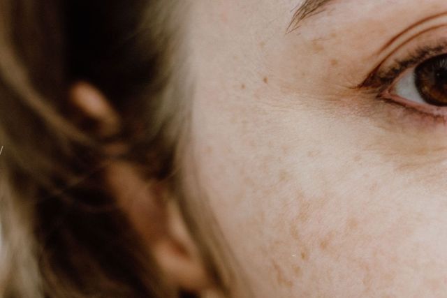 MEDICAL-GRADE SKINCARE