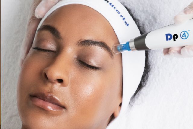 microneedling blurb small